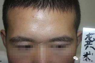 男士种植欧美眉毛视频